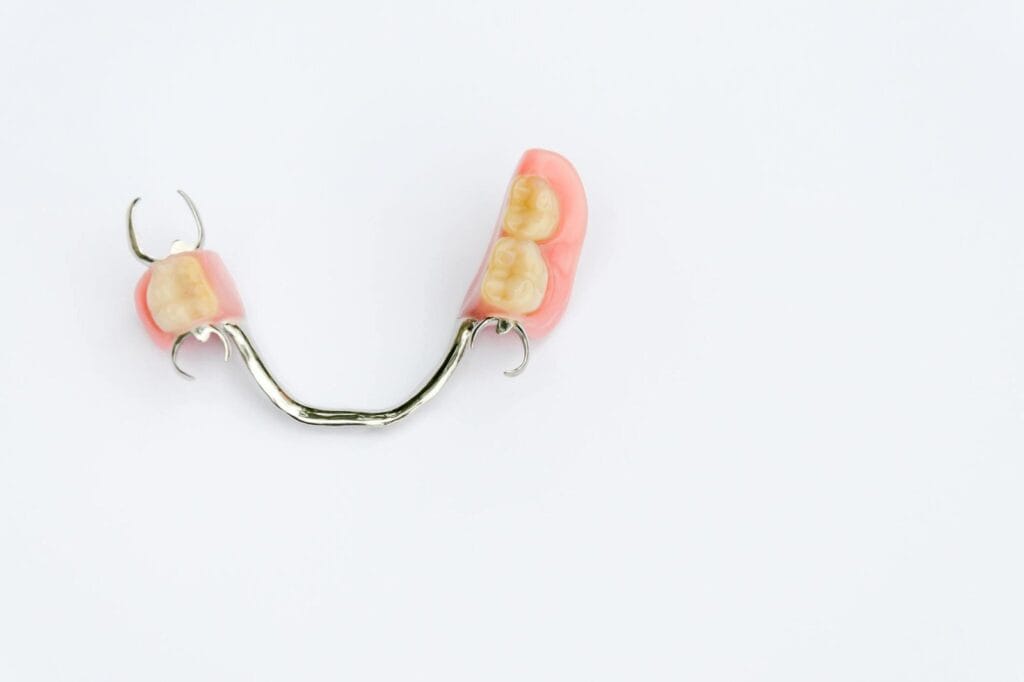 metal partial denture